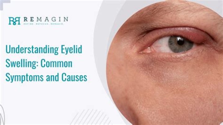 How do you know if swelling is serious?