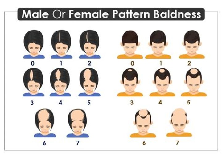 Is balding common in Japan?