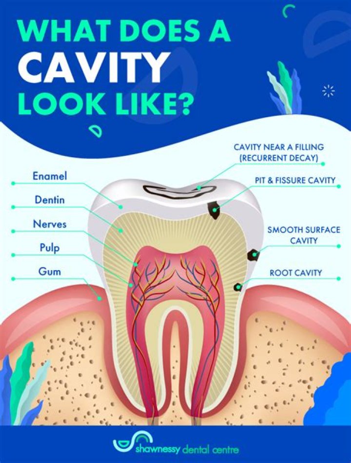 What does a tooth cavity smell like?